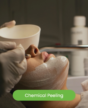 Chemical peeling